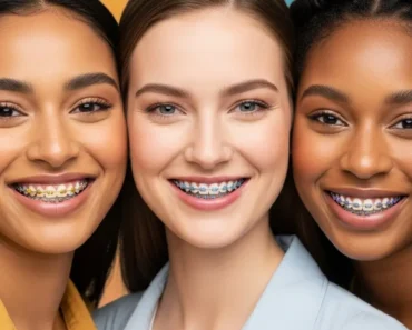 The Bright Side of Braces: How to Pick Braces Color That Show Off Your Smile The Bright Side of Braces: How to Pick Braces Color That Show Off Your Smile
